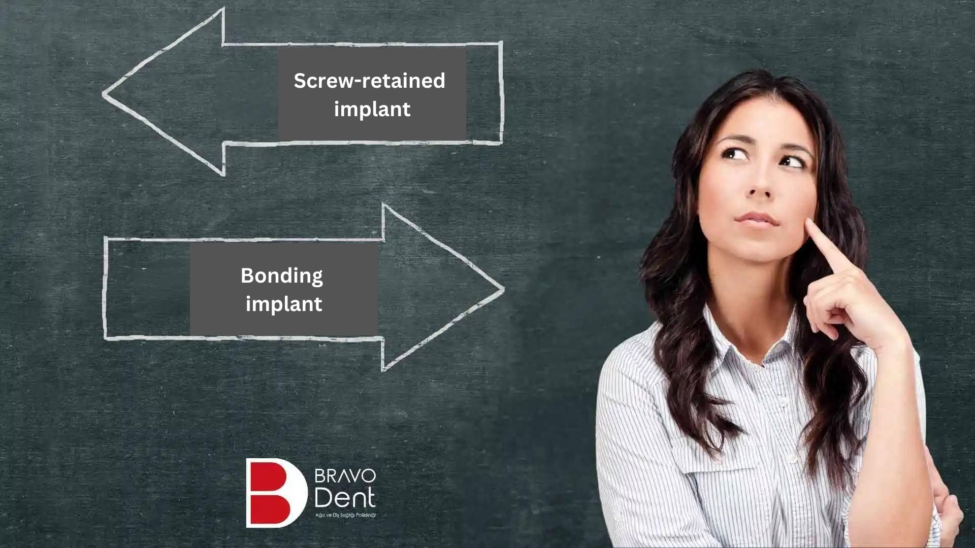 is-screw-retained-implant-better-than-bonding-implant