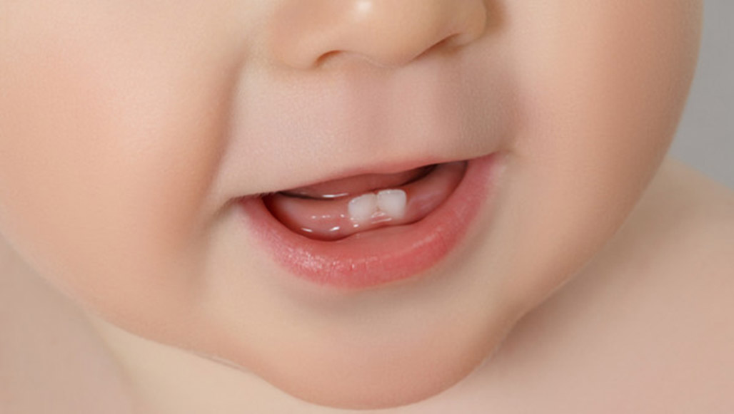 What Is Dental Examination for Babies? in turkey, istanbul