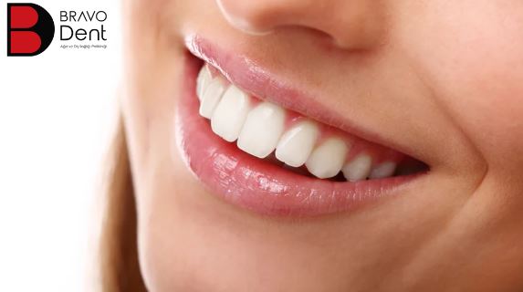 What should be considered after teeth whitening? in Turkey, Istanbul?